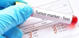 Female Tumor Marker